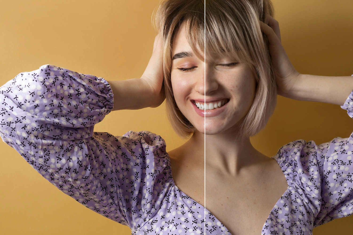 Jak uzyskać pełne korzyści z botoksu?