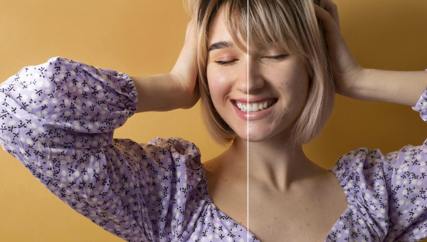 Jak uzyskać pełne korzyści z botoksu?